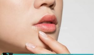 tips-mudah-atasi-bibir-kering-dan-pecah-pecah-mitrapost
