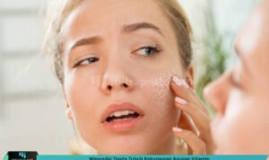 Waspadai Tanda Tubuh Kekurangan Asupan Vitamin Waspadai Tanda Tubuh Kekurangan Asupan Vitamin