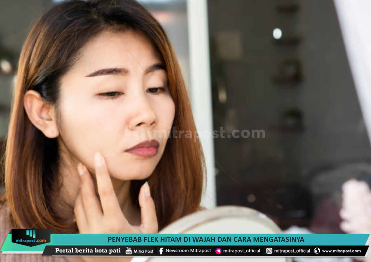 Penyebab Flek Hitam di Wajah dan Cara Mengatasinya