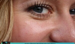 HINDARI KEBIASAAN PENYEBAB KULIT CEPAT MENUA