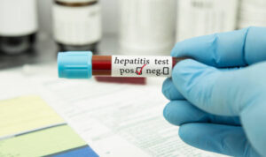Pasien Diduga Penyakit Hepatitis Misterius Ditemukan di Bekasi