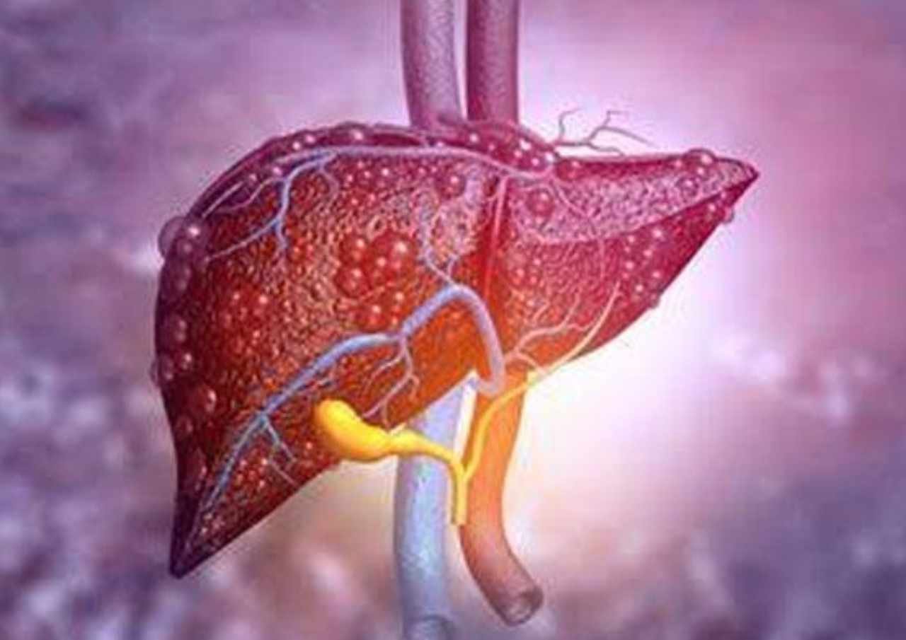 2 Pasien Dinkes Jakarta Diduga Terjangkit Hepatitis Misterius