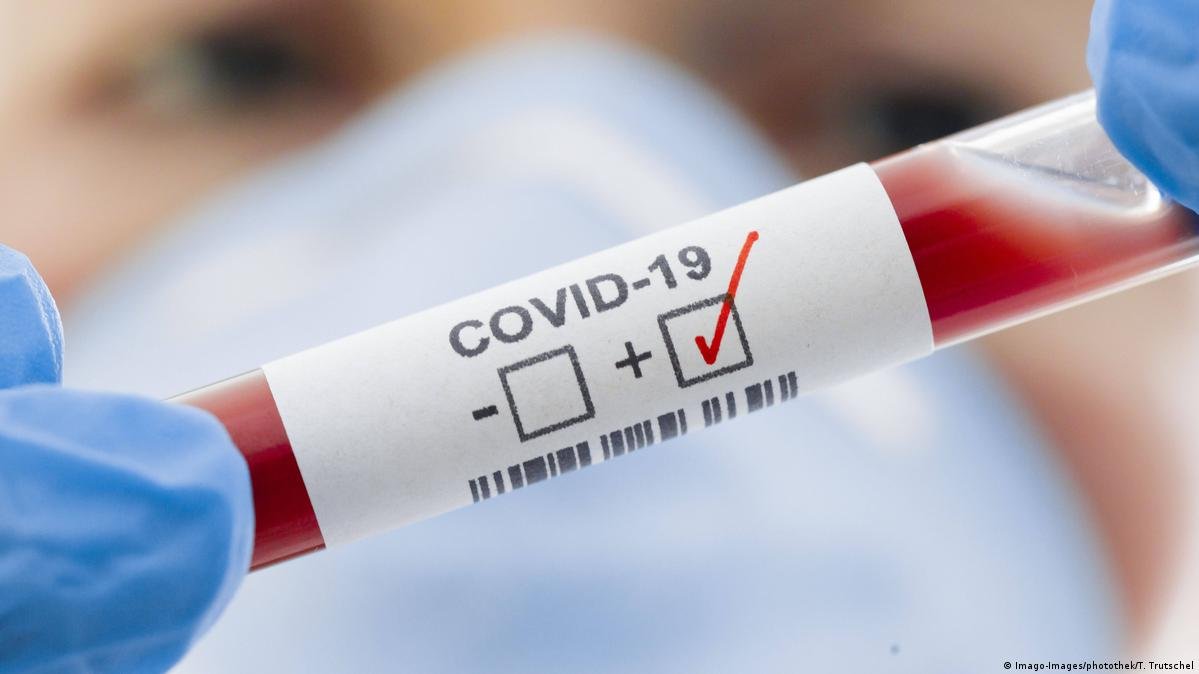 DKI Jakarta Ada di Level 3 Transmisi Covid-19 Menurut WHO