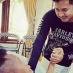 Kondisi Tukul Arwana setelah Pendarahan Otak