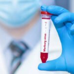 Virus Marburg Telan Korban Jiwa di Afrika, Menkes: Jangan Panik/iStock