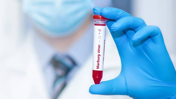 Virus Marburg Telan Korban Jiwa di Afrika, Menkes: Jangan Panik/iStock