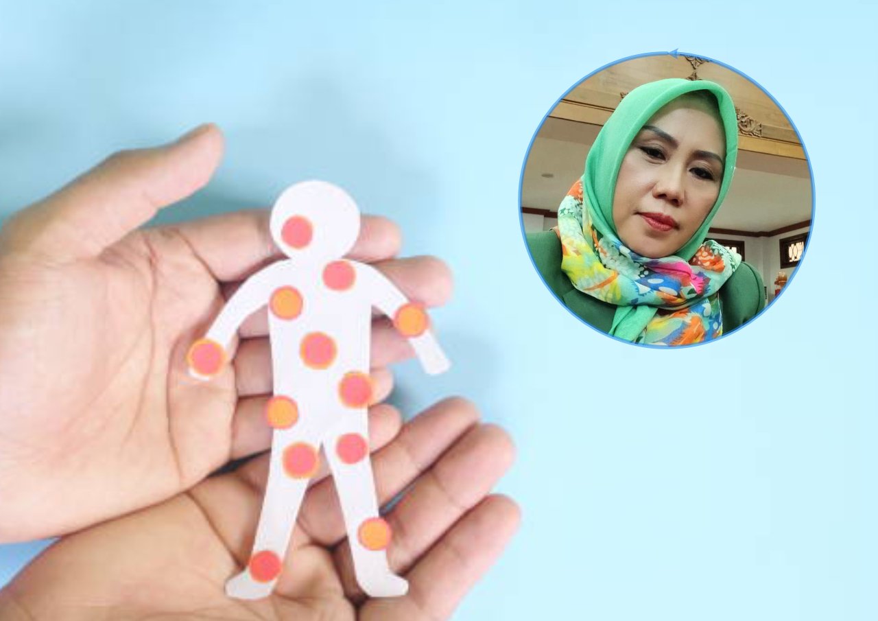 Foto: Ilustrasi cacar monyet (Sumber: istock)