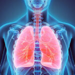Foto: Ilustrasi penyakit Pneumonia (Sumber: istock)