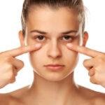 Cara Atasi Mata Sembab Karena Menangis atau Bangun Tidur Cara Atasi Mata Sembab Karena Menangis atau Bangun Tidur