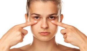 Cara Atasi Mata Sembab Karena Menangis atau Bangun Tidur