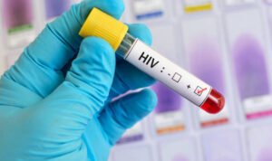 Foto: Ilustrasi HIV/AIDS (Sumber: istock)