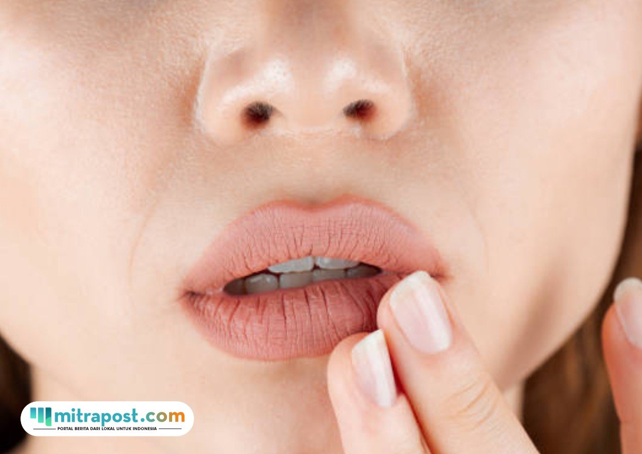 bibir-kering