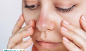 Tips Meminimalkan Efek Purging Setelah Menggunakan Skincare Baru