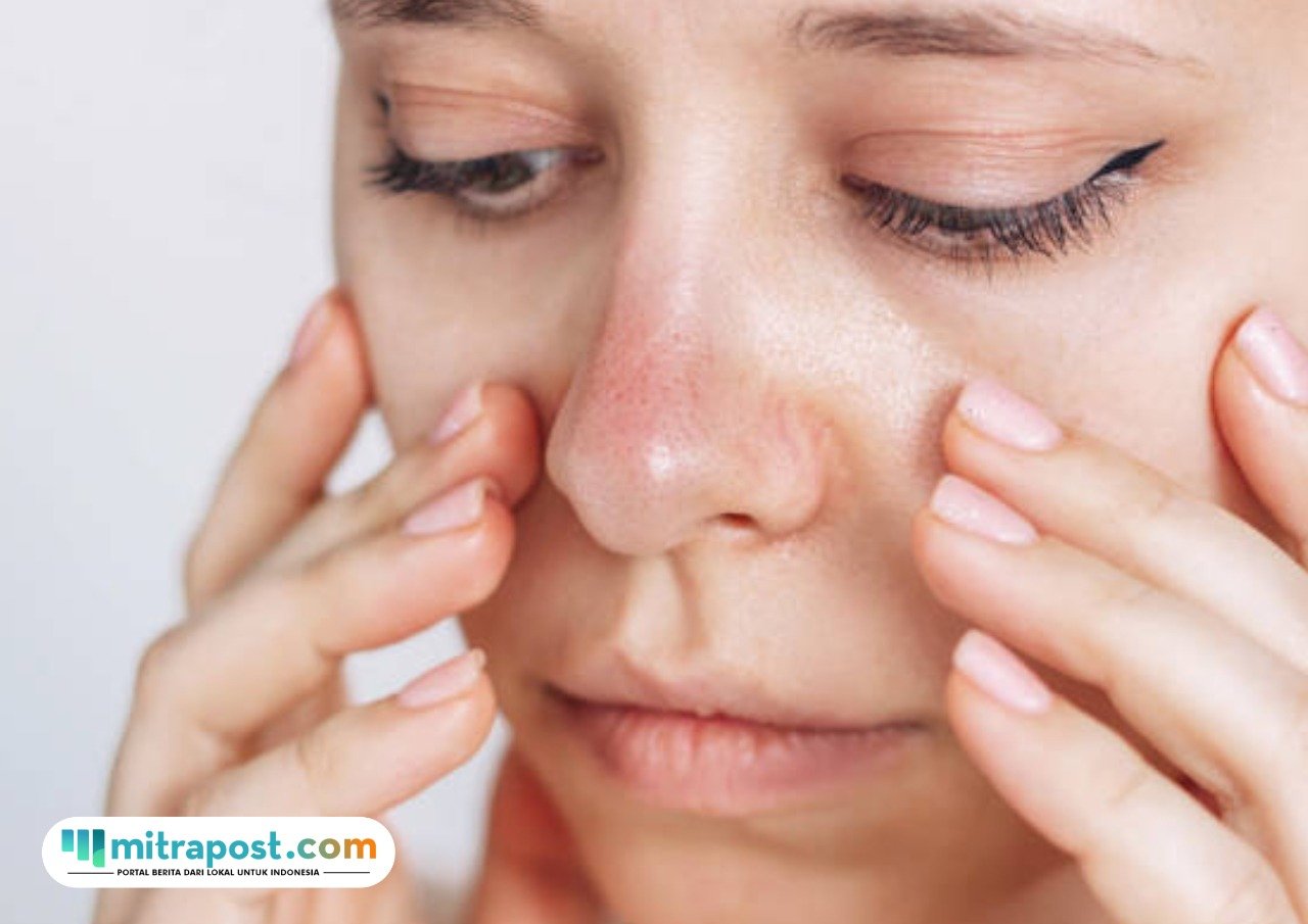 Tips Meminimalkan Efek Purging Setelah Menggunakan Skincare Baru