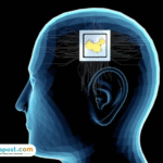 Foto: Ilustrasi penanaman chip ke otak manusia (sumber: istock)