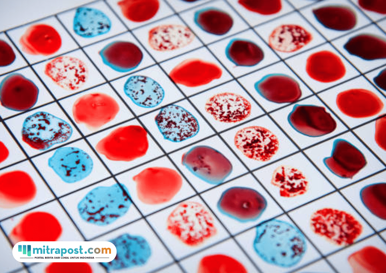 Hanya Dimiliki 50 Orang di Dunia, Golden Blood Jadi Fenomena Medis Paling Unik