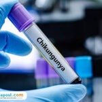 Ilustrasi Chikungunya/istock