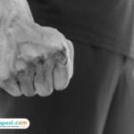 WN AS Terlibat Baku Hantam dengan Pekerja Proyek di Badung Bali