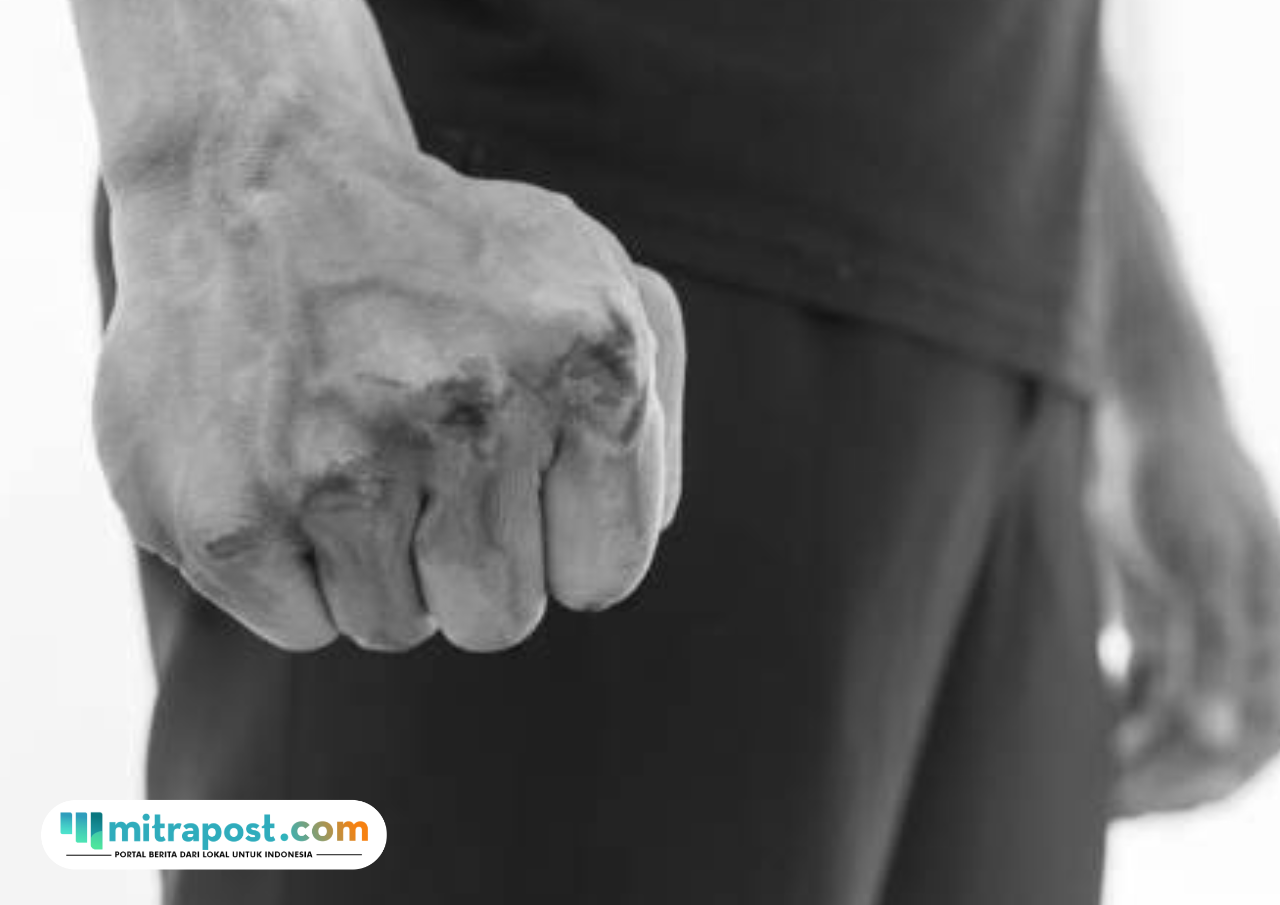 WN AS Terlibat Baku Hantam dengan Pekerja Proyek di Badung Bali