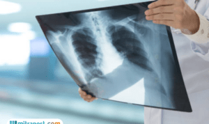 Bagaimana Cara Menjaga Kesehatan Paru-Paru dalam Aktivitas Harian?