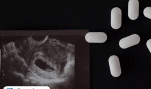 Ilustrasi pil aborsi/istock Mahasiswi Aborsi