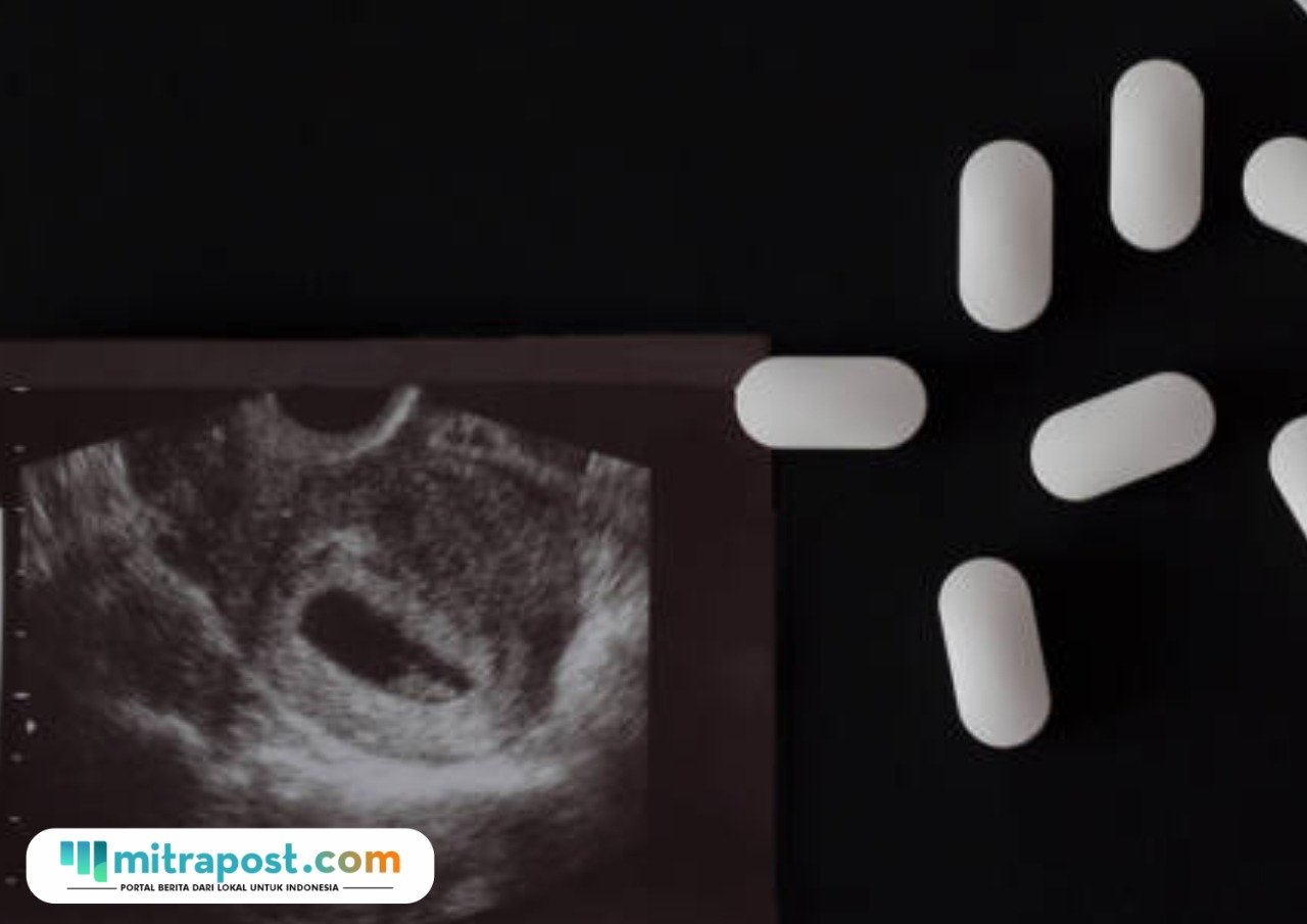 Ilustrasi pil aborsi/istock Mahasiswi Aborsi