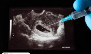 Ilustrasi Klinik Aborsi Ilegal /istock