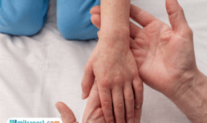 Ribuan Warga Terdampak Banjir Aceh Masih Mulai Terserang Penyakit di Pengungsian