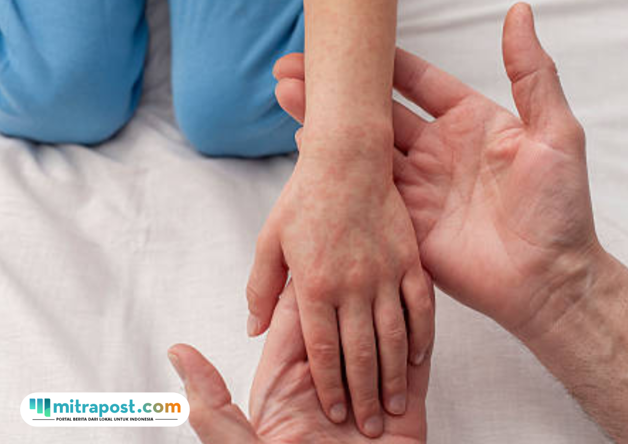 Ribuan Warga Terdampak Banjir Aceh Masih Mulai Terserang Penyakit di Pengungsian