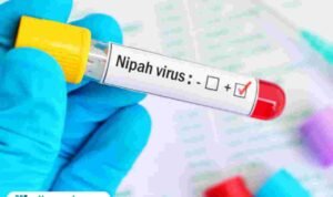 Ilustrasi virus Nipah/istock
