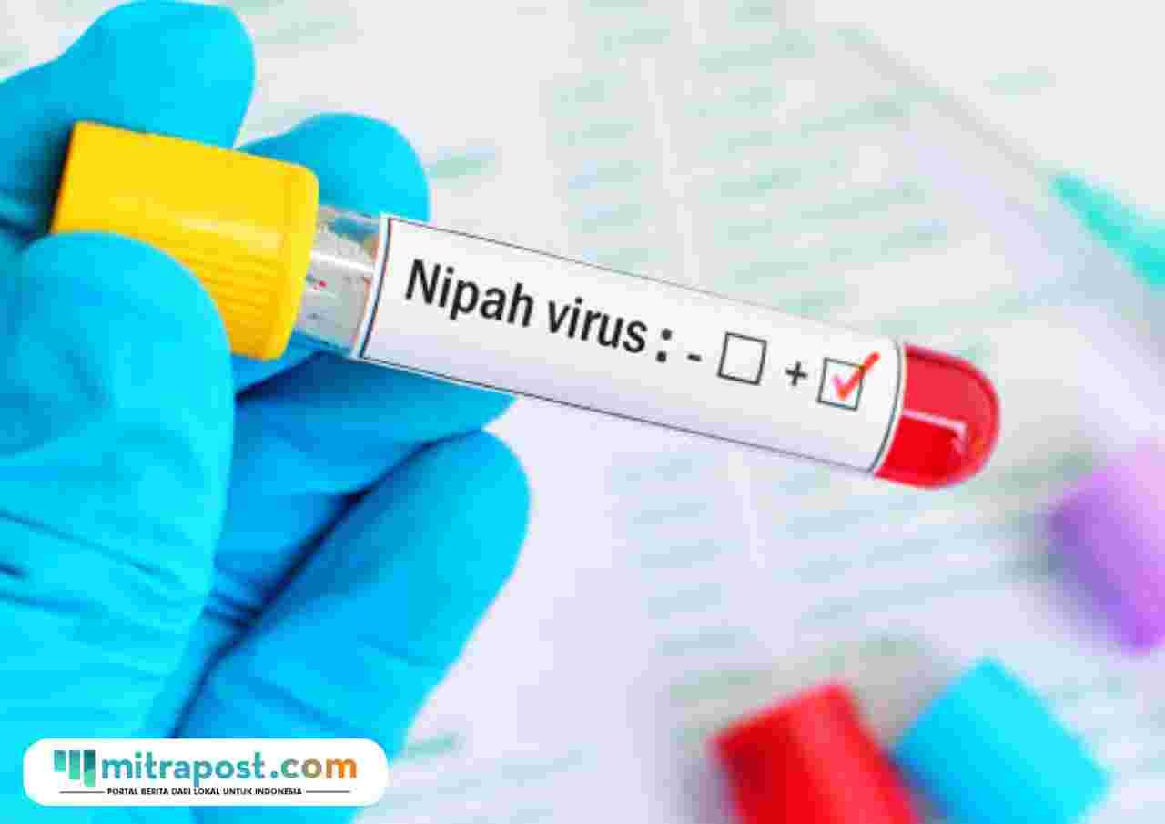 Ilustrasi virus Nipah/istock