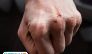 Driver Ojol Laporkan Dugaan Kasus Pemukulan di Jalan Raya Citayam Depok