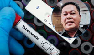 Wamenkes Sebut 2.658 Kasus TBC di Pati, Ketua DPRD Jelaskan Adanya Penambahan Alat Kesehatan