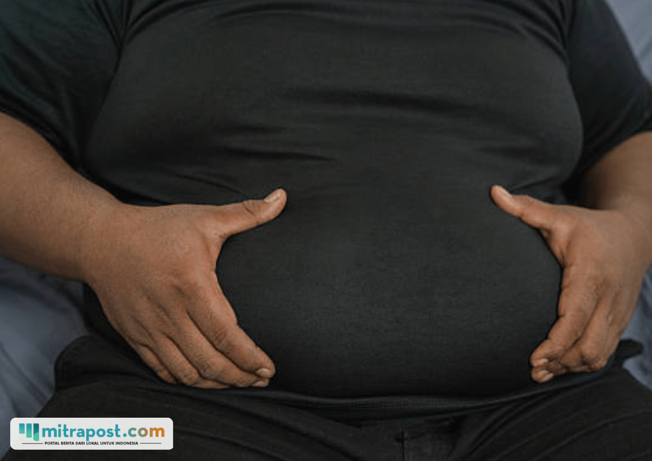 Ilustrasi obesitas/istock